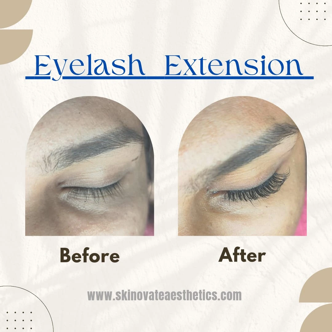 Eyelash Extention – after