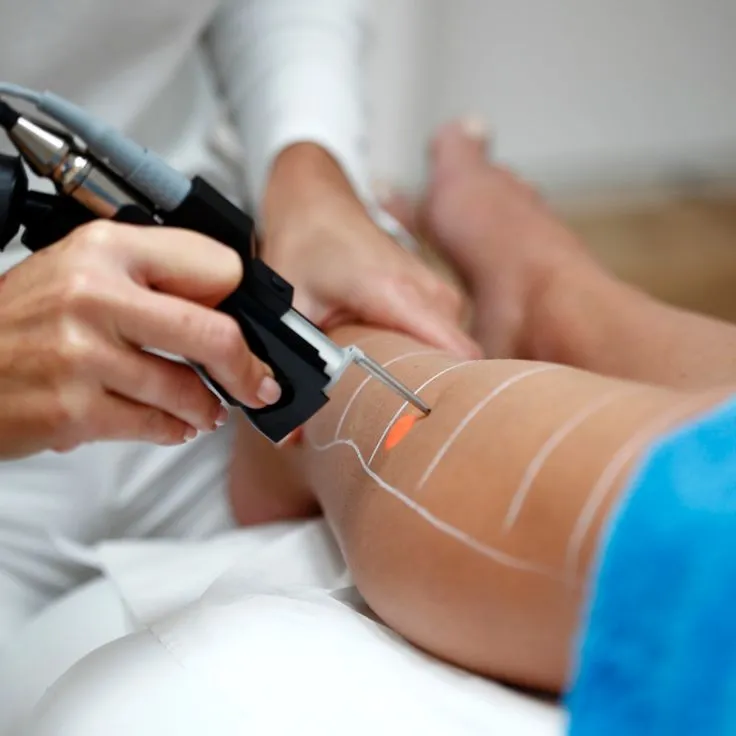 Leg Hair Removal