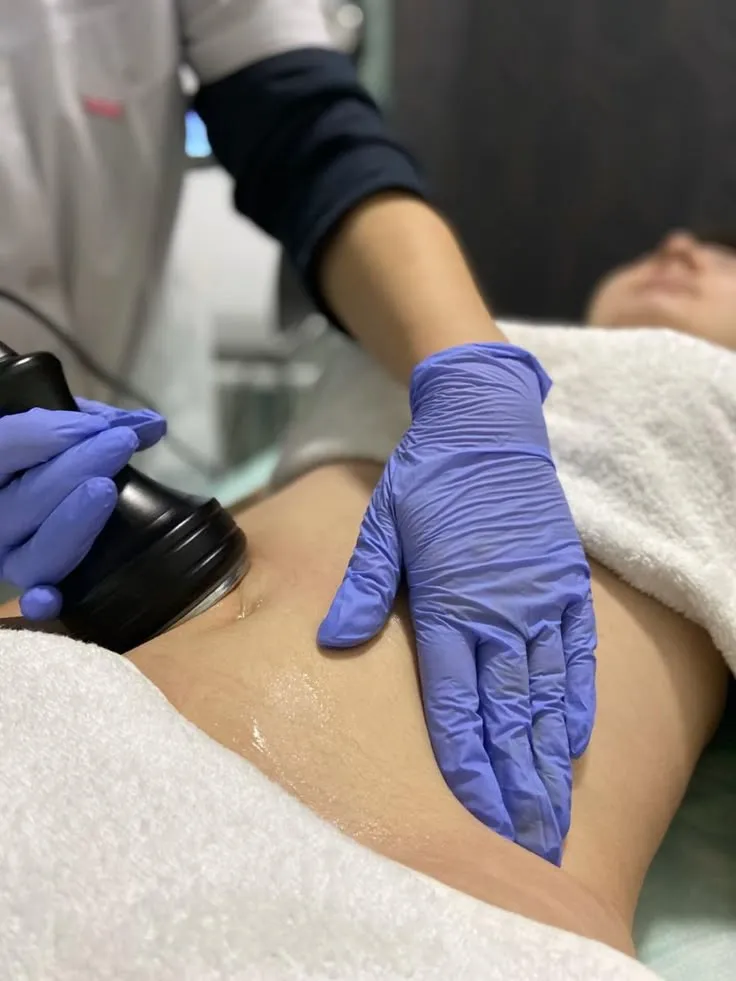 Skin Tone and Texture Correction at Skinovate
