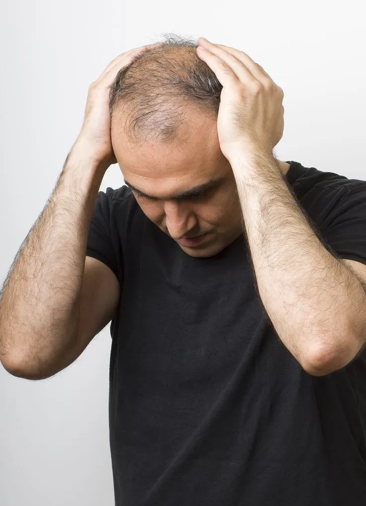 Hair Loss Treatment
