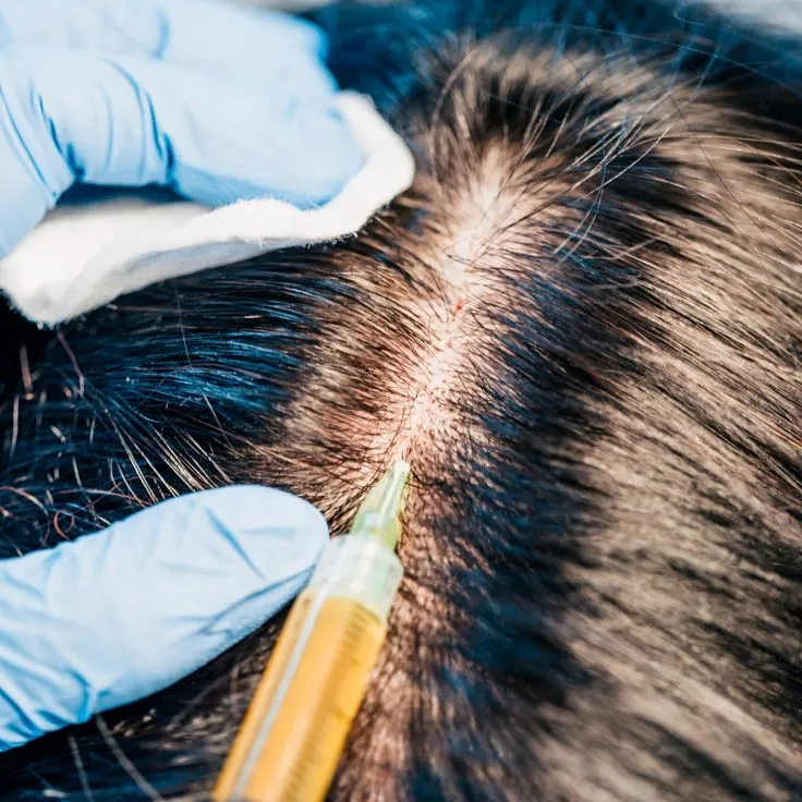 Hair Regrowth Treatment