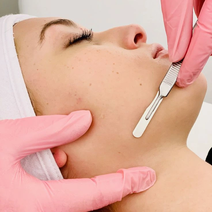 Dermaplaning Treatment at Skinovate Coimbatore